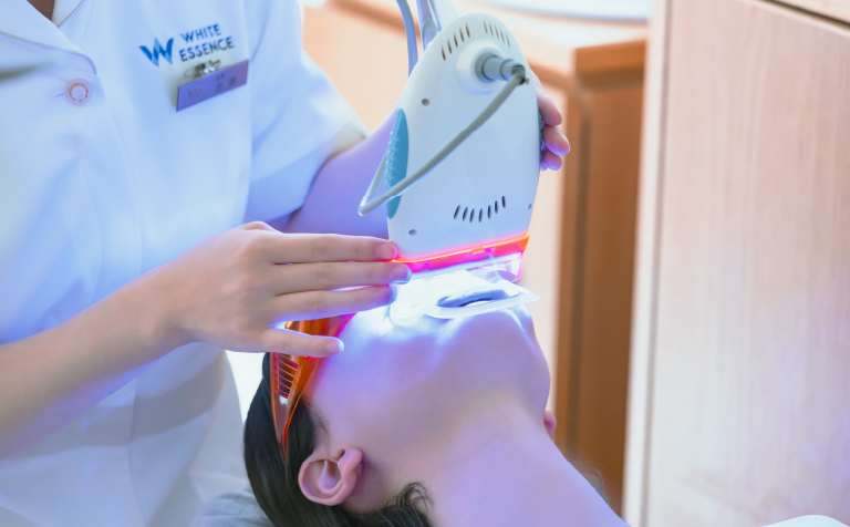 5つをチェック!オフィスホワイトニング材の選び方